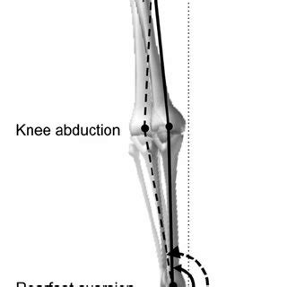 Schematic illustration of the compensatory motion in the frontal view.... | Download Scientific ...