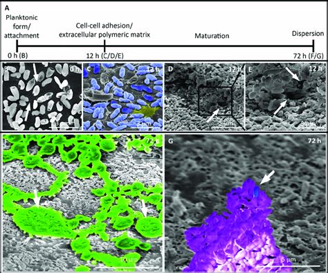 Scanning electron microscopy (SEM) of biofilm production by Pseudomonas... | Download Scientific ...