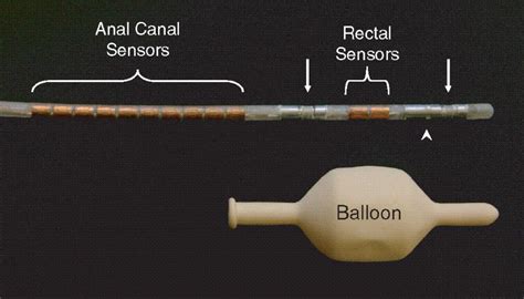 Anorectal Manometry | SpringerLink