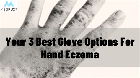 Your 3 Best Glove Options For Hand Eczema - Medrux