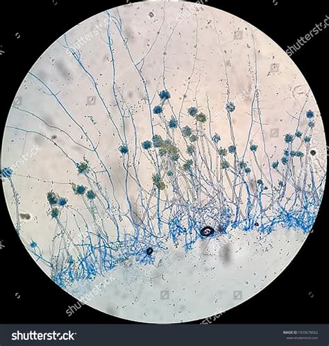 Aspergillus Sp Conidia Hyphae Under Microscope Foto Stok 1933678562 | Shutterstock