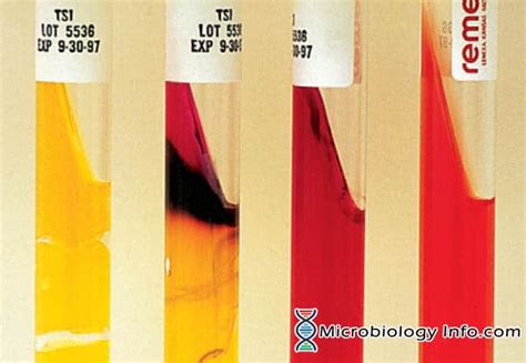 The Triple Sugar Iron (TSI) Test - Procedure, Uses and Interpretation