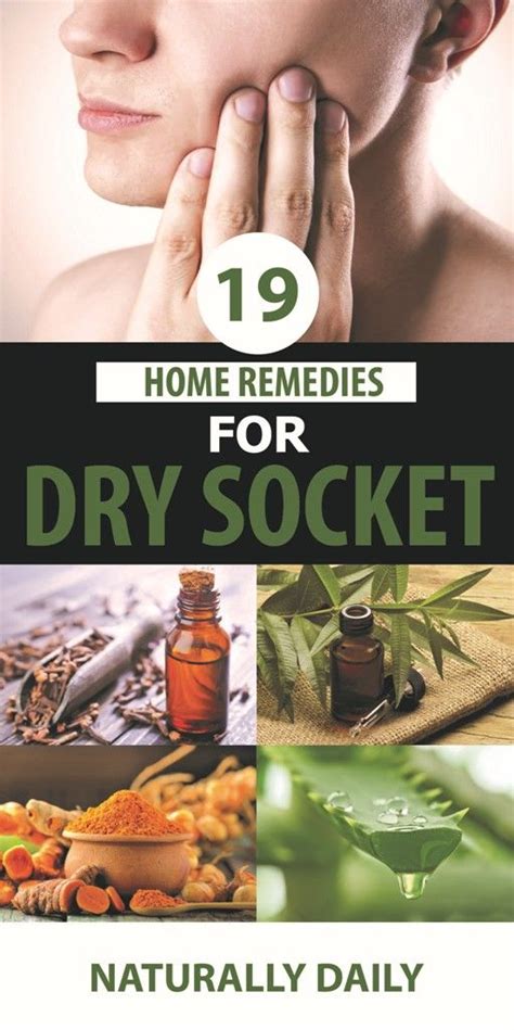 19 Easy Dry Socket Home Remedies in 2020 | Dry socket, Dry socket ...