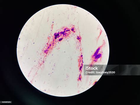 Bacteria Cell In Sputum Sample Gram Stain Method Stock Photo - Download ...