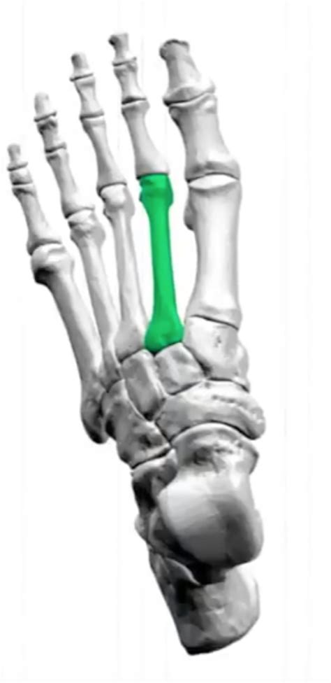 Capsulitis of the Second Toe & the Most Effective Treatments