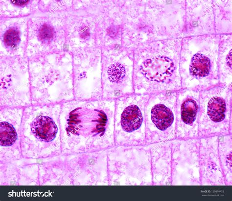 Mitosis In Onion Cells Of The Root Meristem. In The Central Rowof Cells ...