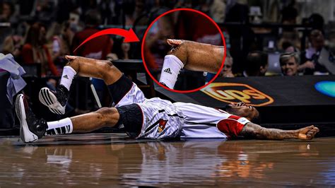 The Worst NBA Injuries and Their Comebacks - Injury in NBA History 2023 ...