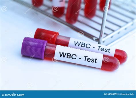 WBC Test To Look for Abnormalities from Blood Stock Image - Image of medical, health: 264508055