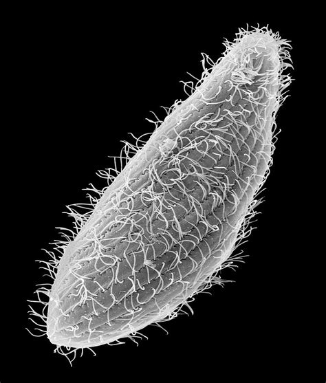 Ciliate Protozoa