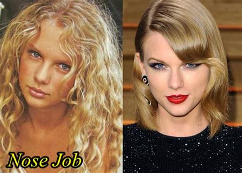 Taylor Swift Plastic Surgery Before And After Photos