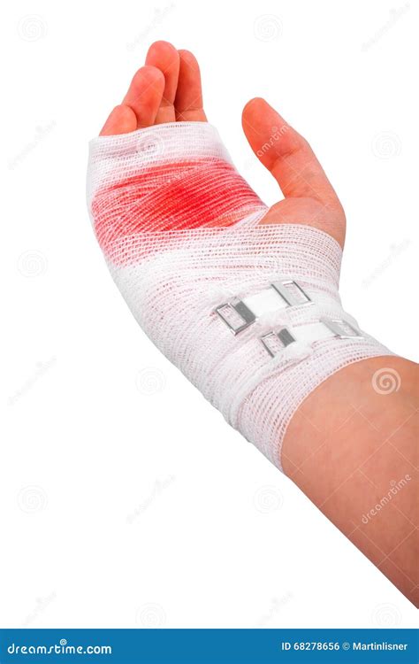 Bandage On Blood Wound Head Stock Photo | CartoonDealer.com #16479996