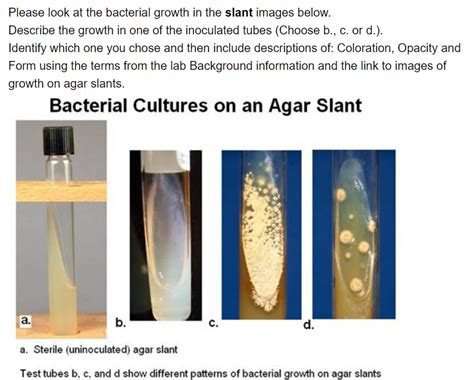 Solved Background for Microbial Growth on Slants and Broths | Chegg.com