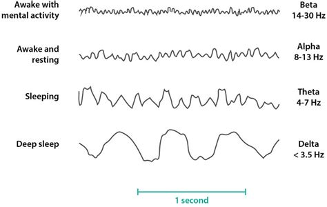 MA in Computational Arts blog › Artefacts using human brainwaves