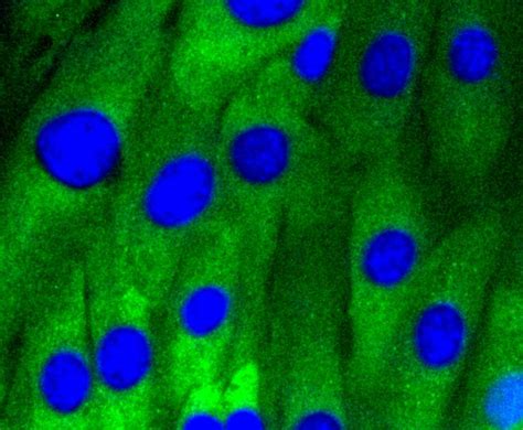 Caveolin 1 Antibody (MA5-32020)