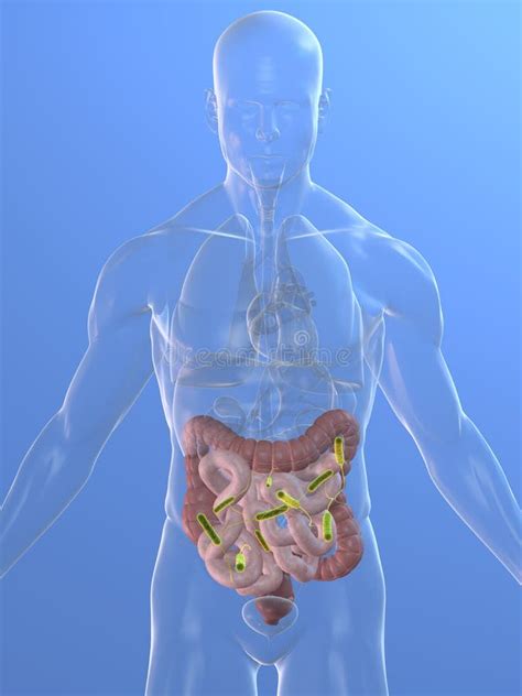 Colon infection stock illustration. Illustration of inflamed - 11734446