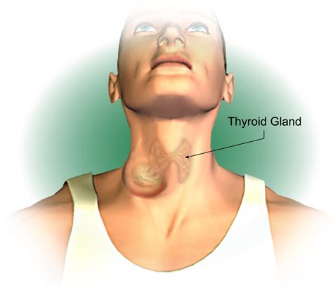 Symptoms of Thyroid Cancer - American Head & Neck Society