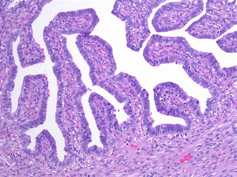 Pathology Outlines Anatomy Histology Embryology Features To Report | My ...