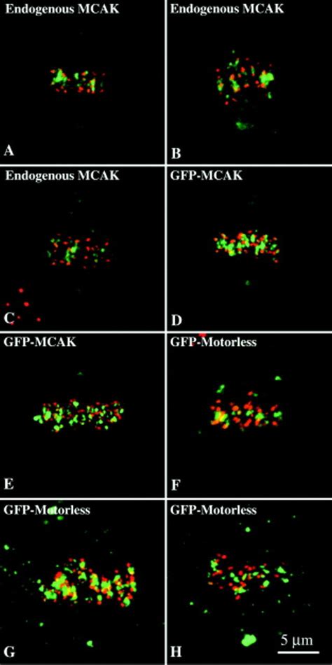 Metaphase alignment in GFP-motorless-transfected cells. Projected... | Download Scientific Diagram