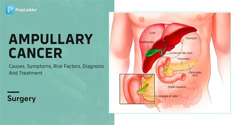 Ampullary Cancer: Causes, Symptoms, Risk Factors, Diagnosis and Treatment