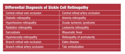 Spotlight on Sickle Cell Retinopathy