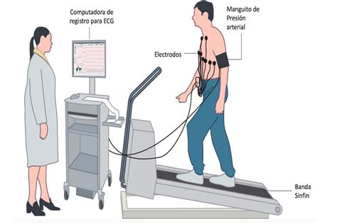 Prueba de Esfuerzo | Dr. Yitzar Bañuelos Millán