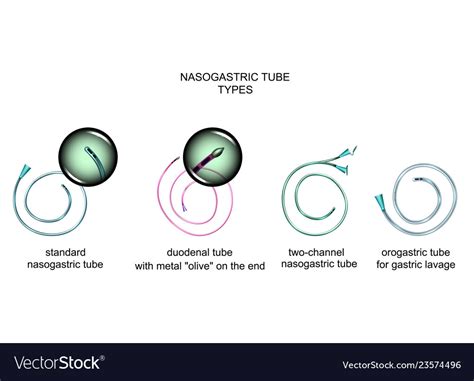 Lanzamiento Disparo Parlamento types of nasogastric tube Elasticidad ...