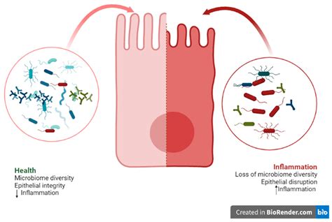 IJMS | Free Full-Text | Use of the Probiotic Bifidobacterium animalis subsp. lactis HN019 in ...