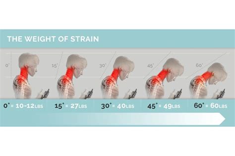 Bad Posture Causes Headaches. Here's How to Stop Them – BackEmbrace