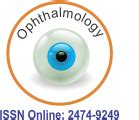 Comparison of Effect of Contact Lenses on Daily Life in Myopia and Myopic Astigmatisma: VF-14 ...