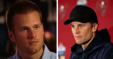 Has Tom Brady had plastic surgery? Expert explains how NFL legend's ...