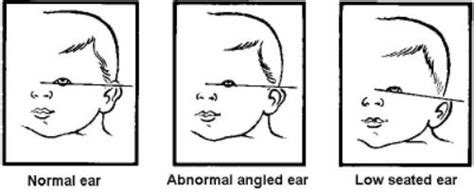 Characteristics of the Typical Newborn Infant