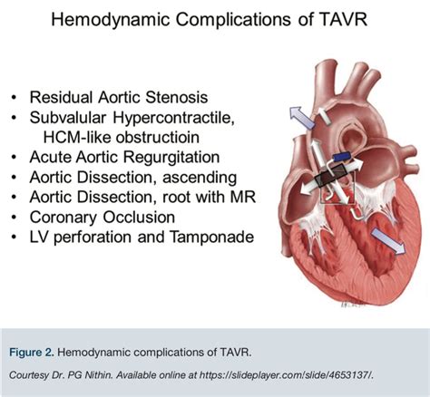 The “Big 5”: Avoiding the Most Dangerous Complications of TAVR