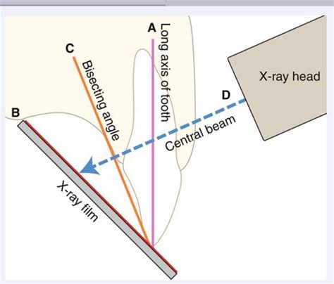 Bisecting angle technique | Vet medicine, Dental hygiene school ...