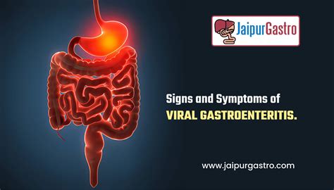 Signs and Symptoms of Viral gastroenteritis - Jaipur Gastro Clinic