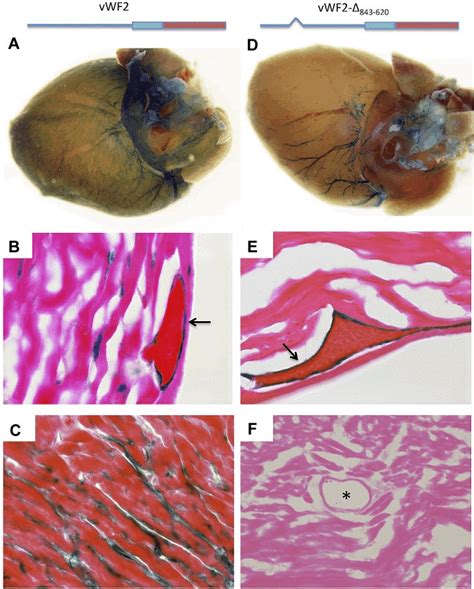 LacZ staining of heart whole mounts and tissue sections from vWF2-lacZ ...