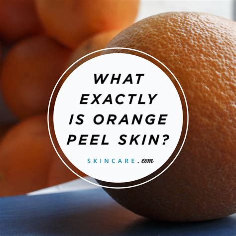 Orange Peel Skin: What Is It, Causes and How to Fix It | Skincare.com powered by L'Oréal ...