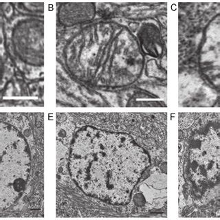 Light microscopy of brain tissue 6 h following the return of ...