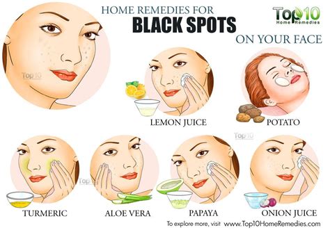 Jescynjoebeauti Blog: Home Remedies for Black Spots on Your Face