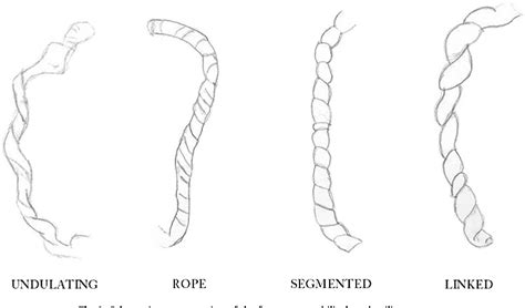 [PDF] Gross patterns of umbilical cord coiling: correlations with placental histology and ...