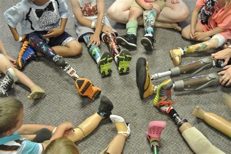 Amputees Are Putting Their Best Foot Forward - GeekMom