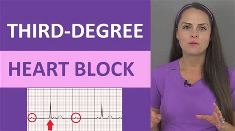 Third-Degree AV Heart Block ECG Nursing Rhythm NCLEX | Complete Heart Block - YouTube