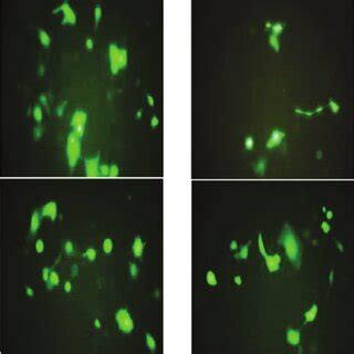 Plasmid transfection efficiency at 48 h following transfection ...