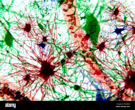 Brain cells Illustration of three types of brain cells: astrocytes (red) pyramidal neurons ...