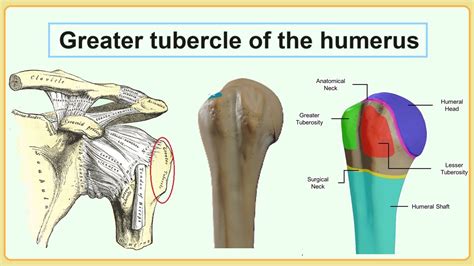 greater tubercle of the humerus - YouTube