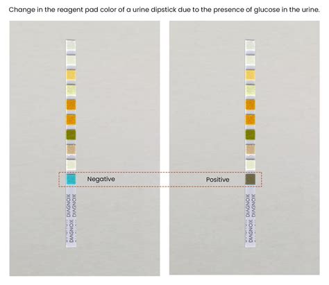 All About Glucose in Urine and Urine Glucose Test Strips