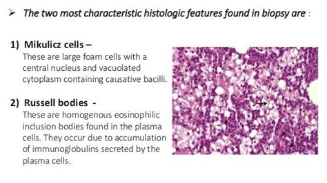 Rhinoscleroma bodies... | Body, Cell, Bacillus