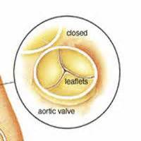 Mitral Valve Leaflets - Anatomy, Pictures, Problems