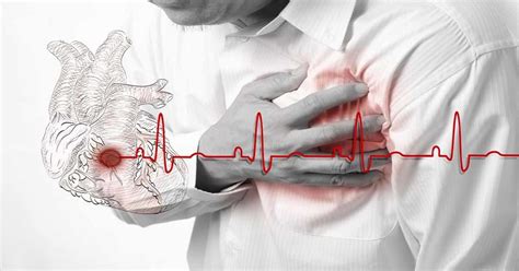 Angina Chest Pain & Tightness, Symptoms, Types & Treatment