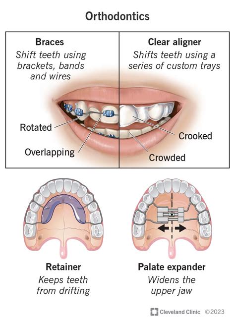 What Is Orthodontics?