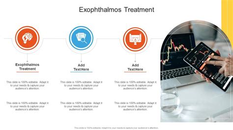 Exophthalmos Treatment In Powerpoint And Google Slides Cpb